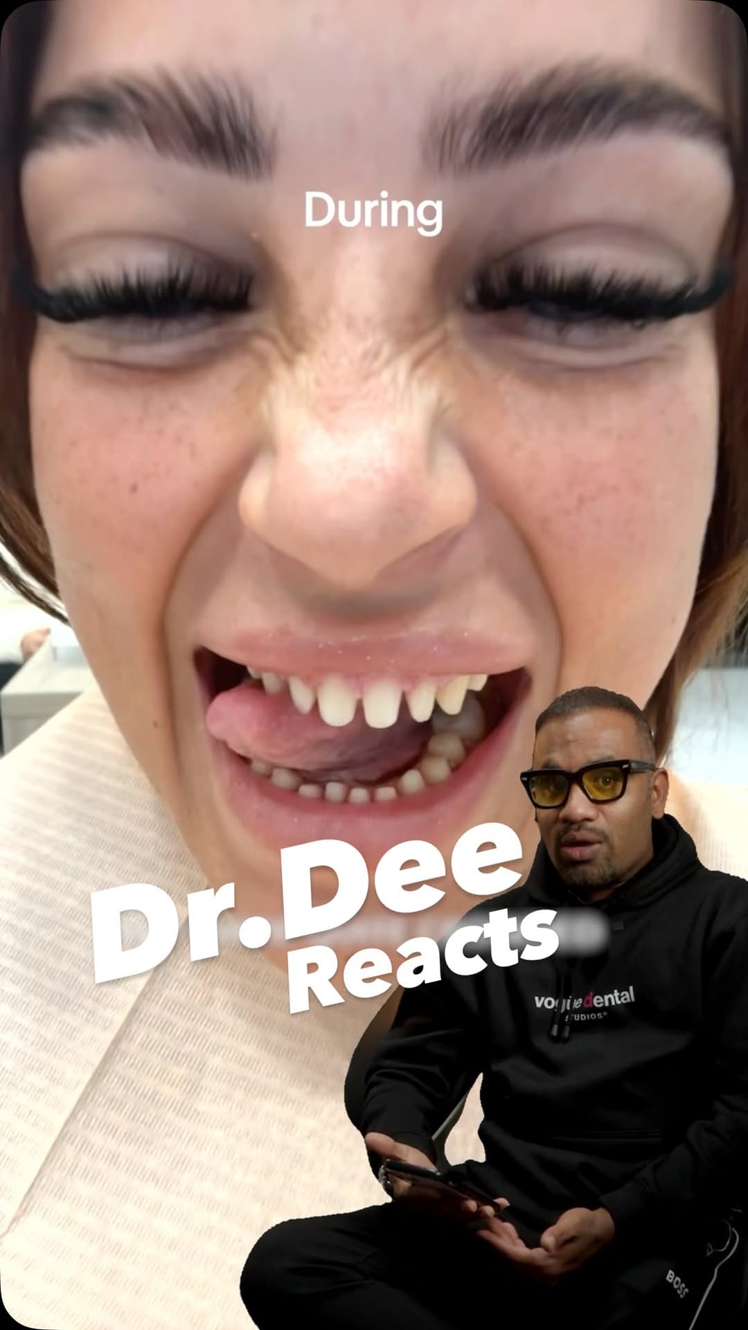 Post 2 by Vogue Dental Studios®️ on Instagram (video)