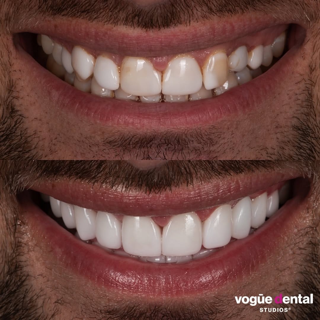 Post 10 by Vogue Dental Studios®️ on Instagram (carousel)