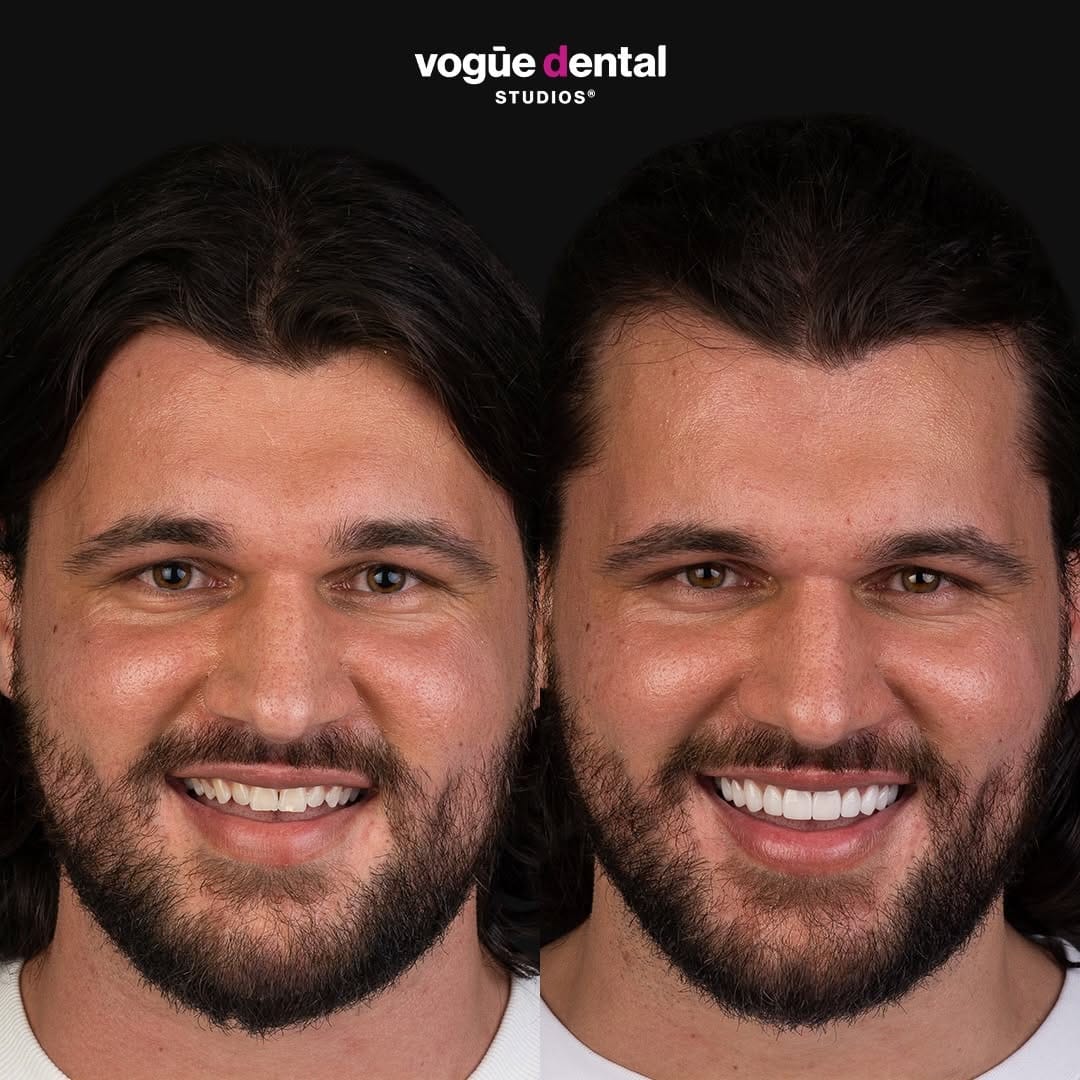 Post 9 by Vogue Dental Studios®️ on Instagram (carousel)