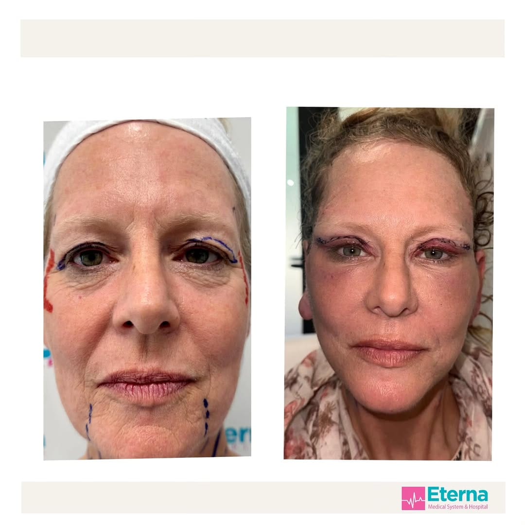 Post 4 by Eterna Hospital_Medical System on Instagram (image)
