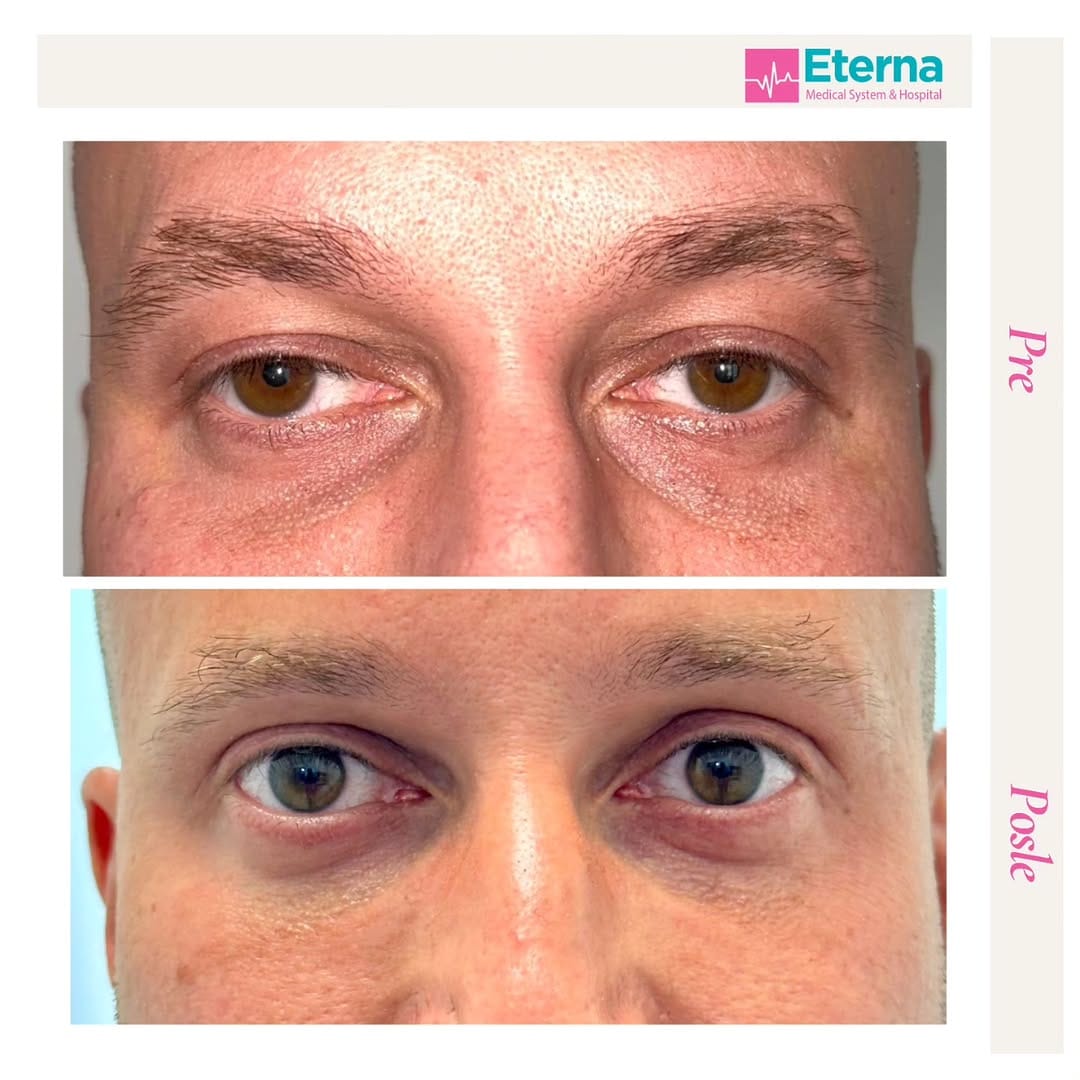 Post 2 by Eterna Hospital_Medical System on Instagram (image)