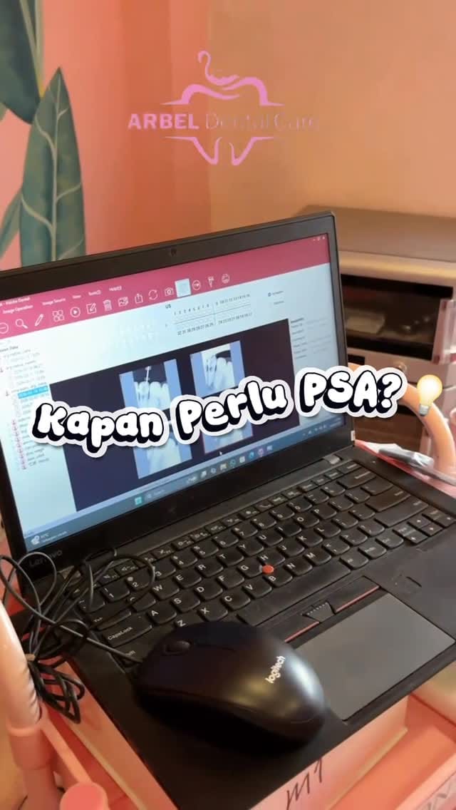 Post 4 by Dokter Gigi Jakarta Timur, Depok, Bekasi on Instagram (video)