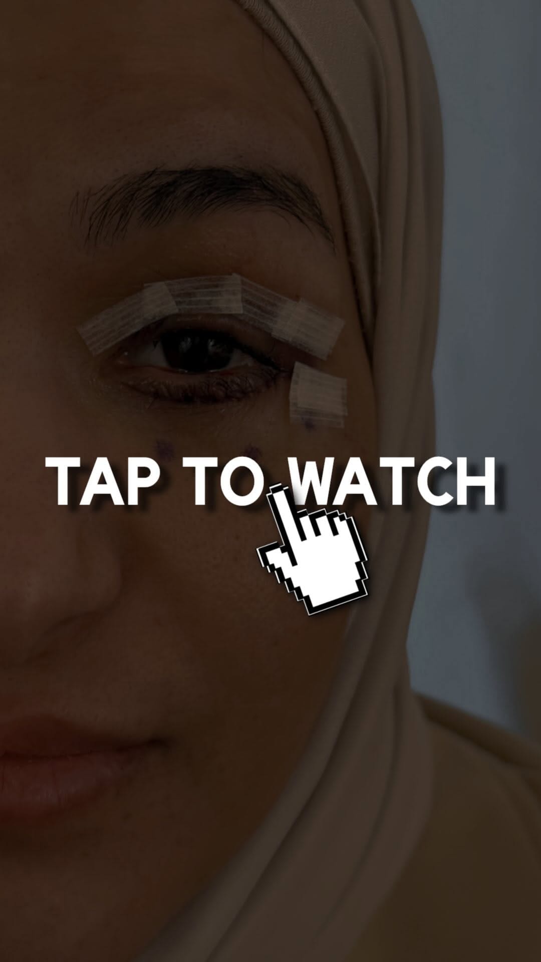 Post 10 by Dr. Zaid Al Abbadi on Instagram (video)