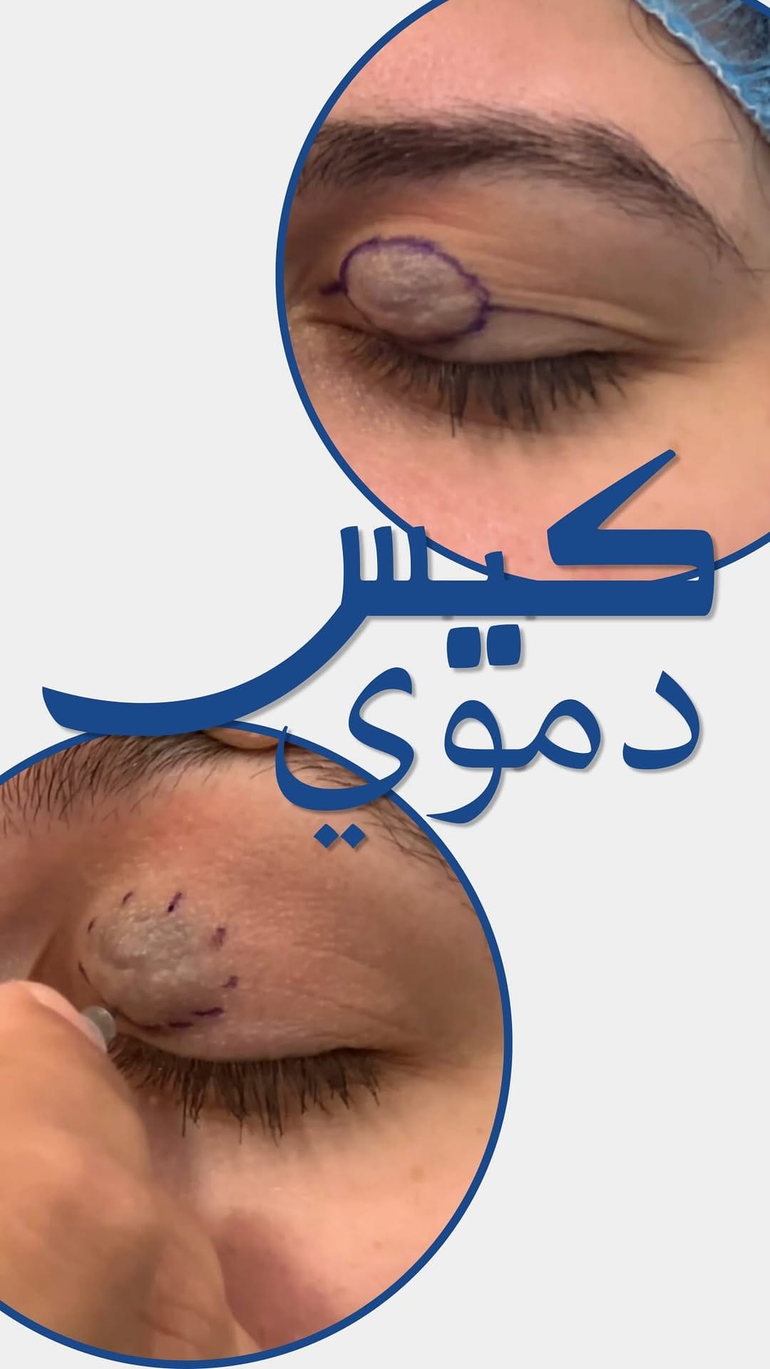 Post 4 by Dr. Zaid Al Abbadi on Instagram (video)