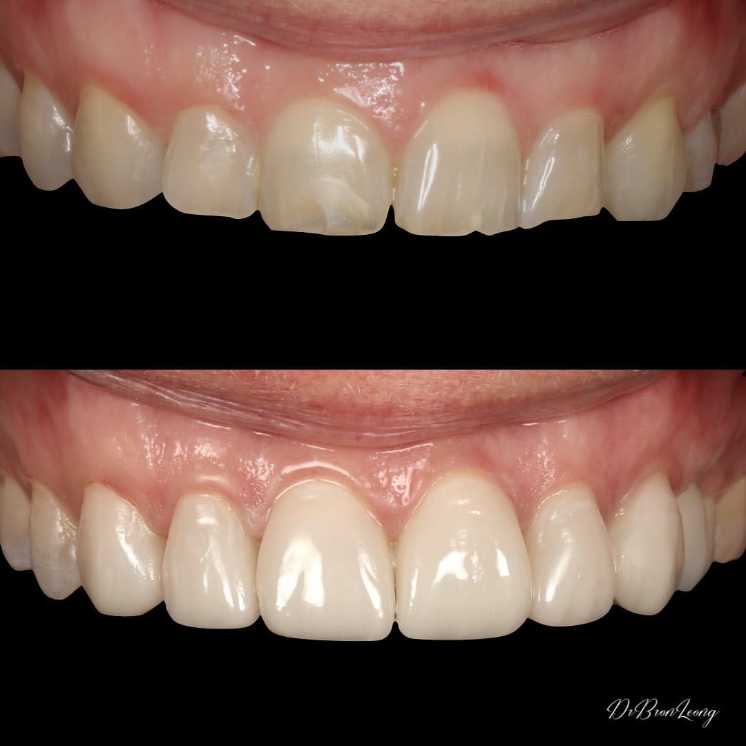 Post 7 by Iconic Dentistry on Instagram (image)