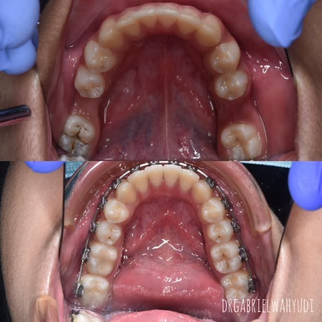 Post 4 by dr Ji Gong | DOKTER GIGI SBY on Instagram (video)