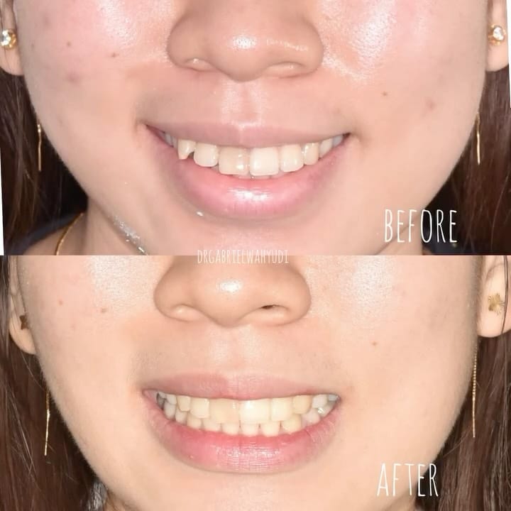 Post 2 by dr Ji Gong | DOKTER GIGI SBY on Instagram (video)