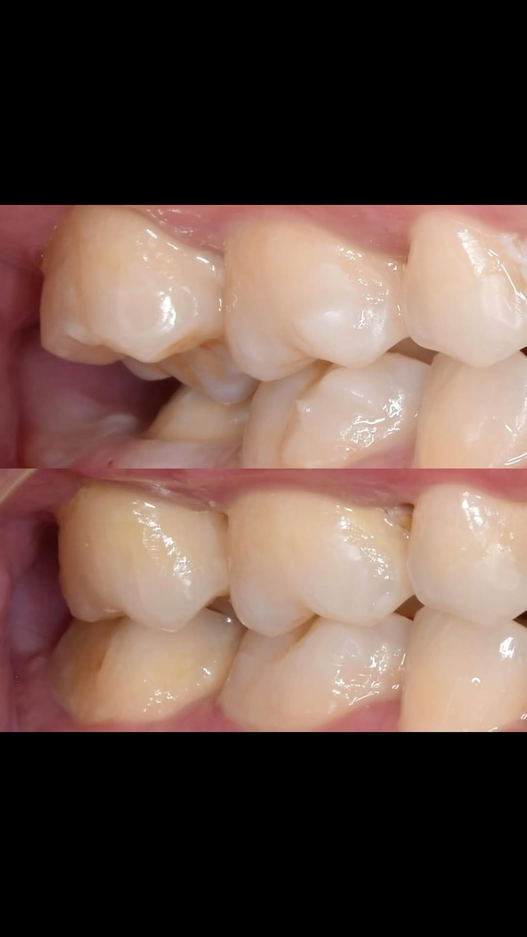 Post 3 by dr Ji Gong | DOKTER GIGI SBY on Instagram (video)