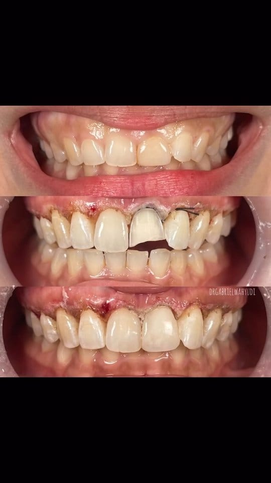 Post 6 by dr Ji Gong | DOKTER GIGI SBY on Instagram (video)