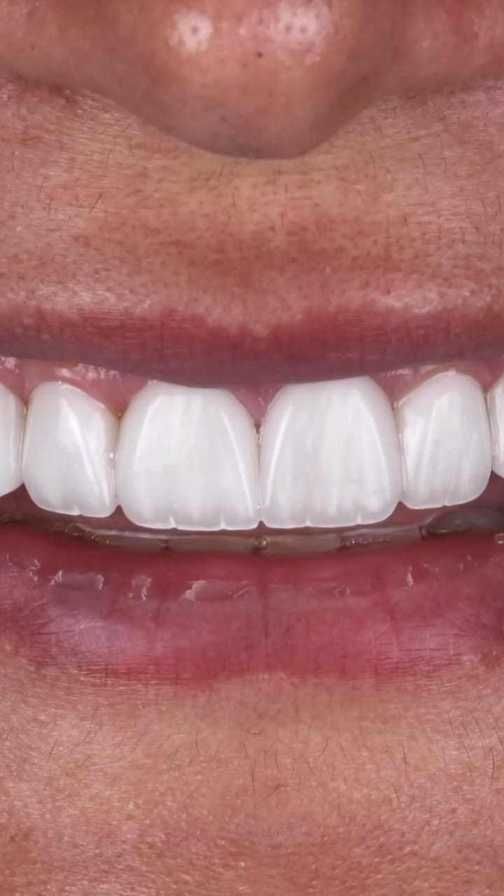 Post 8 by Dr. Raghed Bashour on Instagram (video)