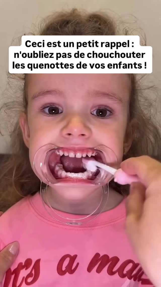 Post 8 by Dentissage on Instagram (video)