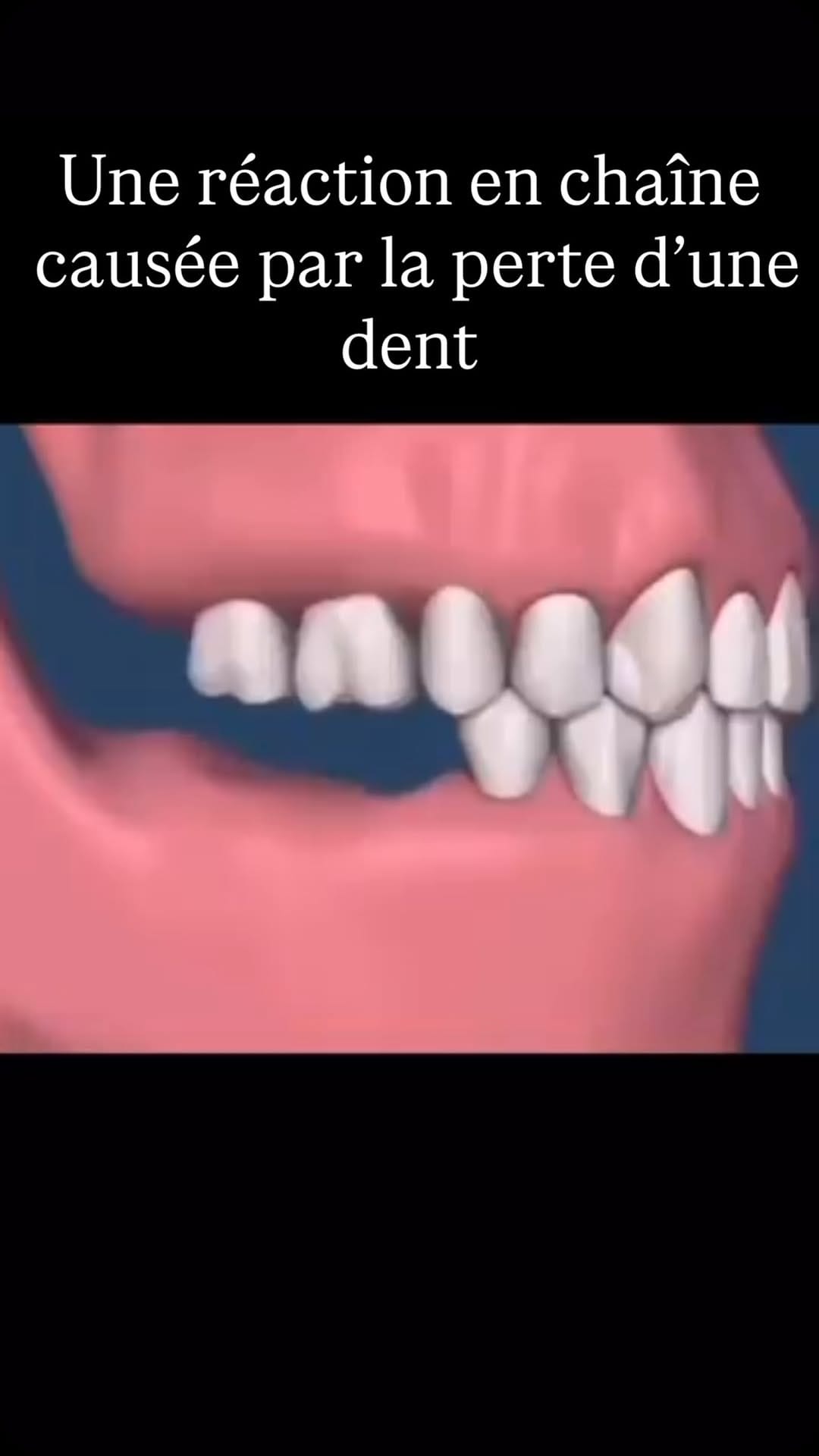 Post 1 by Dentissage on Instagram (video)