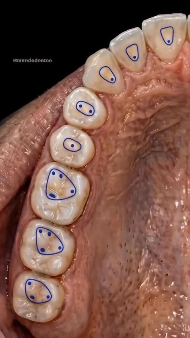 Post 4 by Dentissage on Instagram (video)