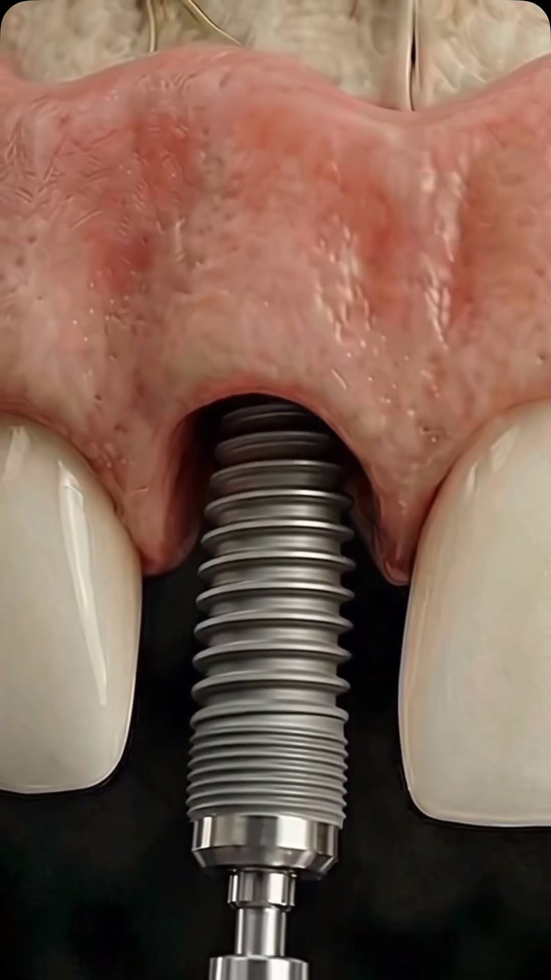 Post 5 by Dentissage on Instagram (video)