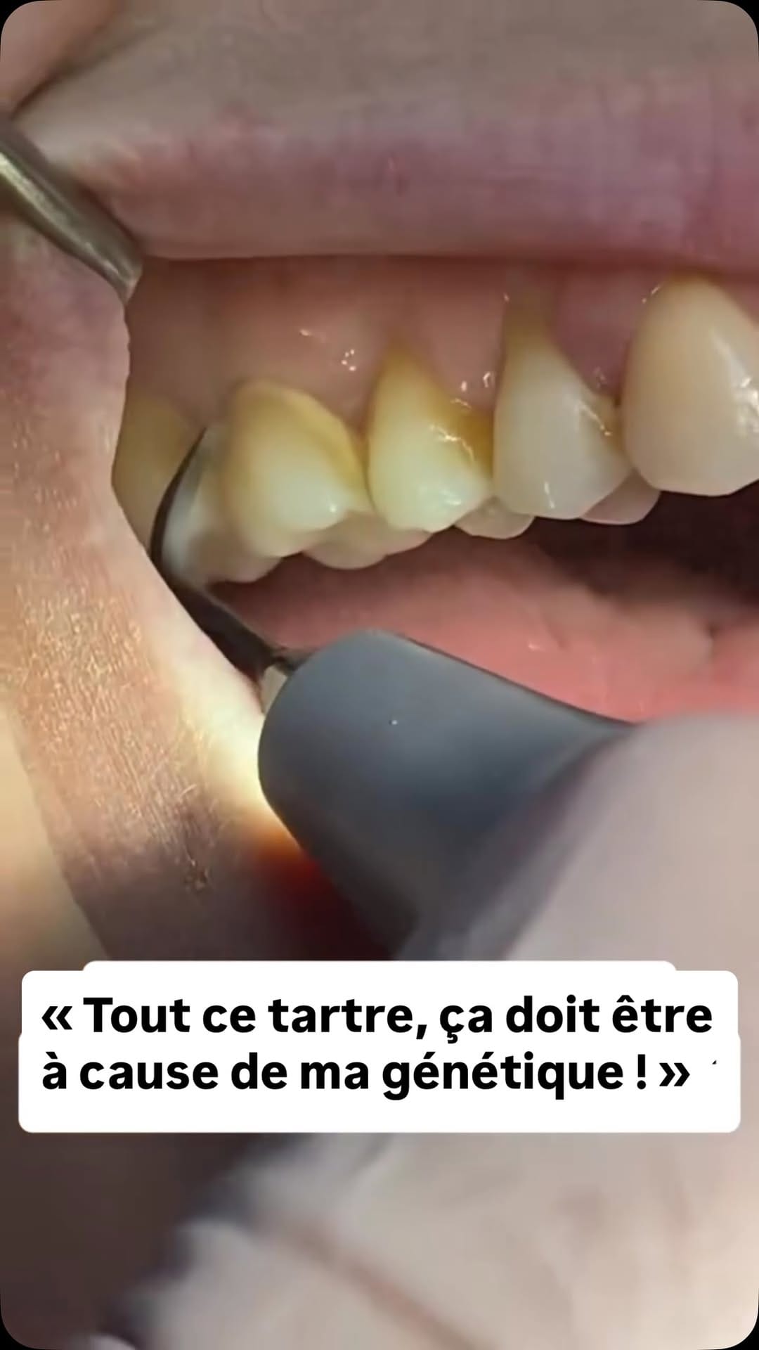 Post 7 by Dentissage on Instagram (video)