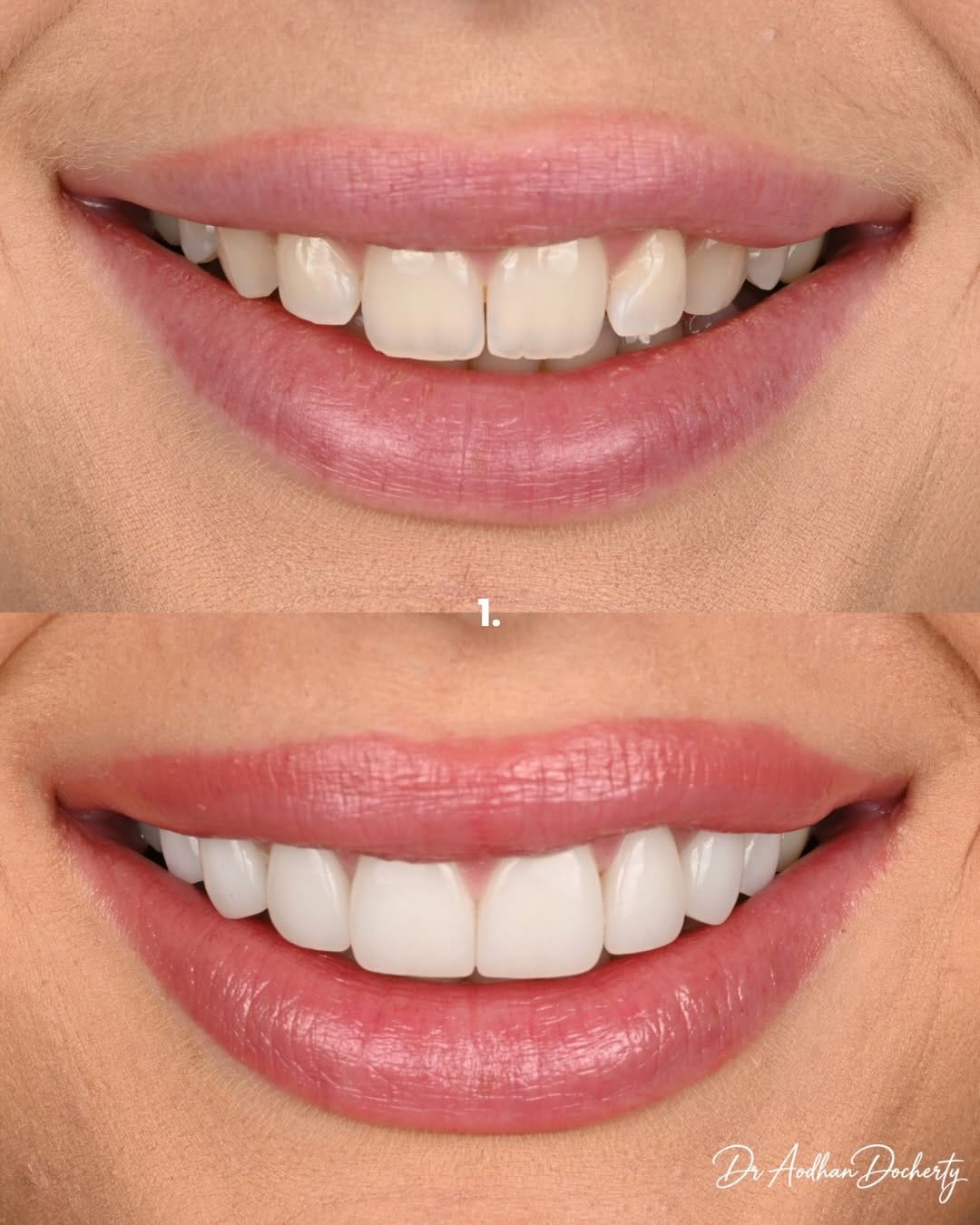 Post 8 by Dr Aodhan Docherty | Dentist Sydney on Instagram (carousel)