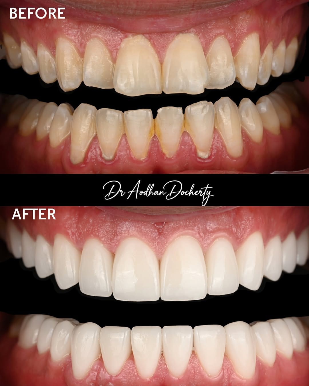 Post 1 by Dr Aodhan Docherty | Dentist Sydney on Instagram (carousel)