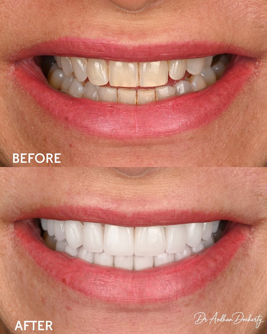 Post 4 by Dr Aodhan Docherty | Dentist Sydney on Instagram (image)