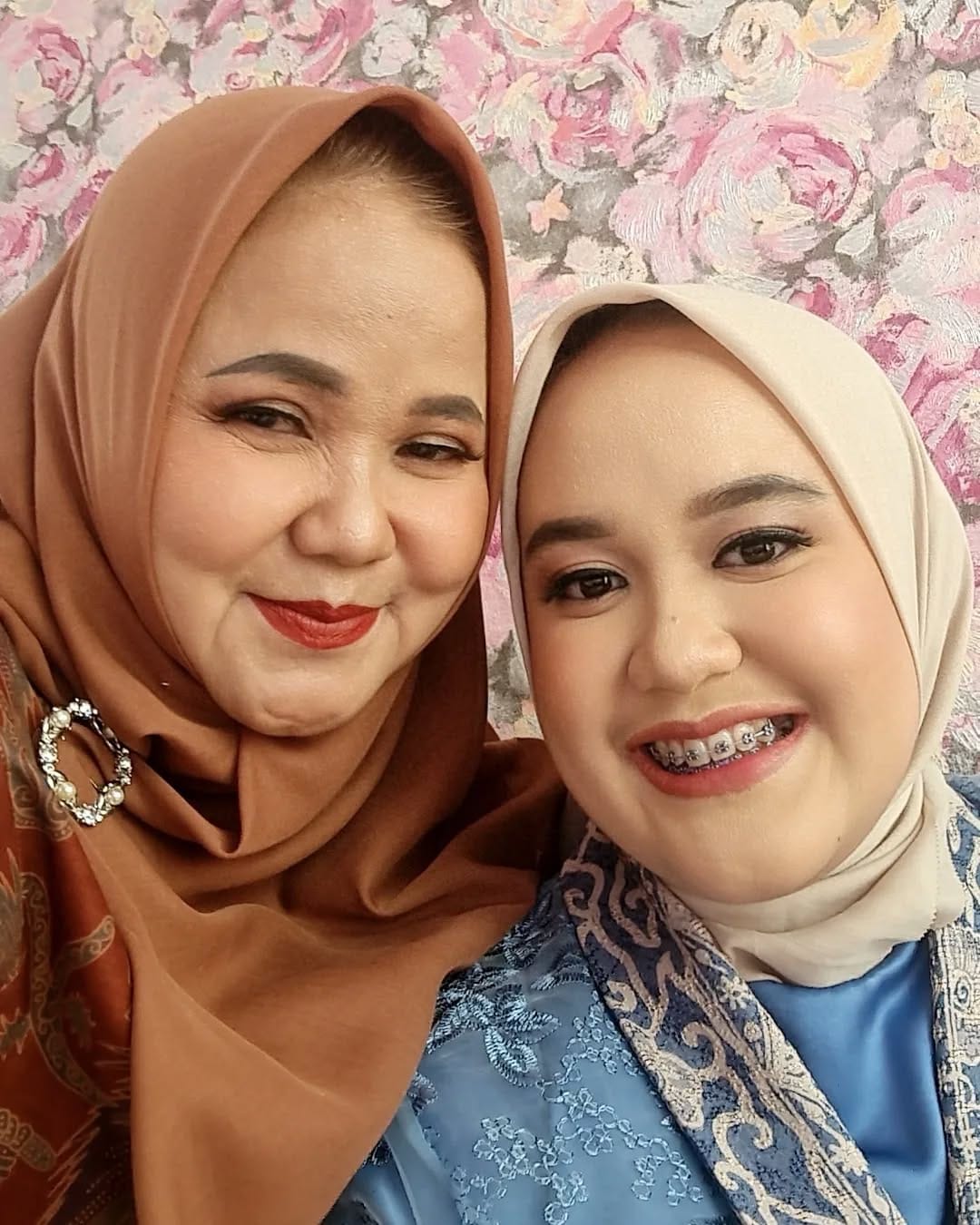 Post 10 by Isma Dentist on Instagram (image)
