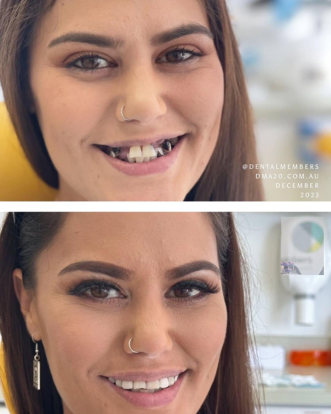 Post 10 by DMA♥️💛🦷 on Instagram (image)