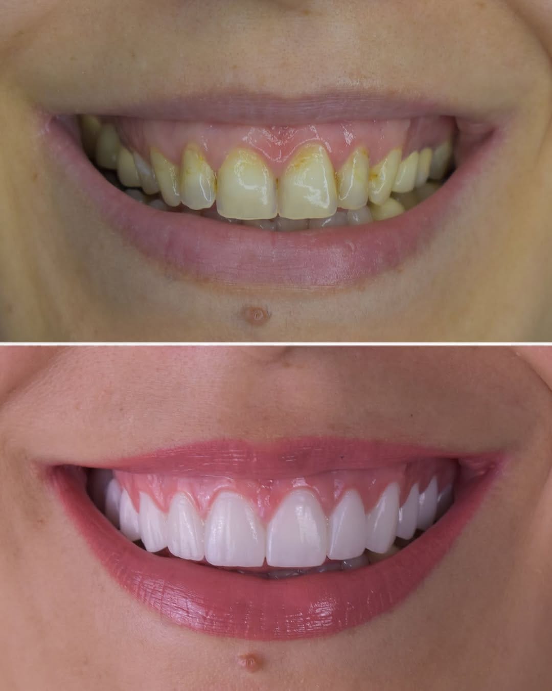 Post 3 by @dental.srbija on Instagram (image)