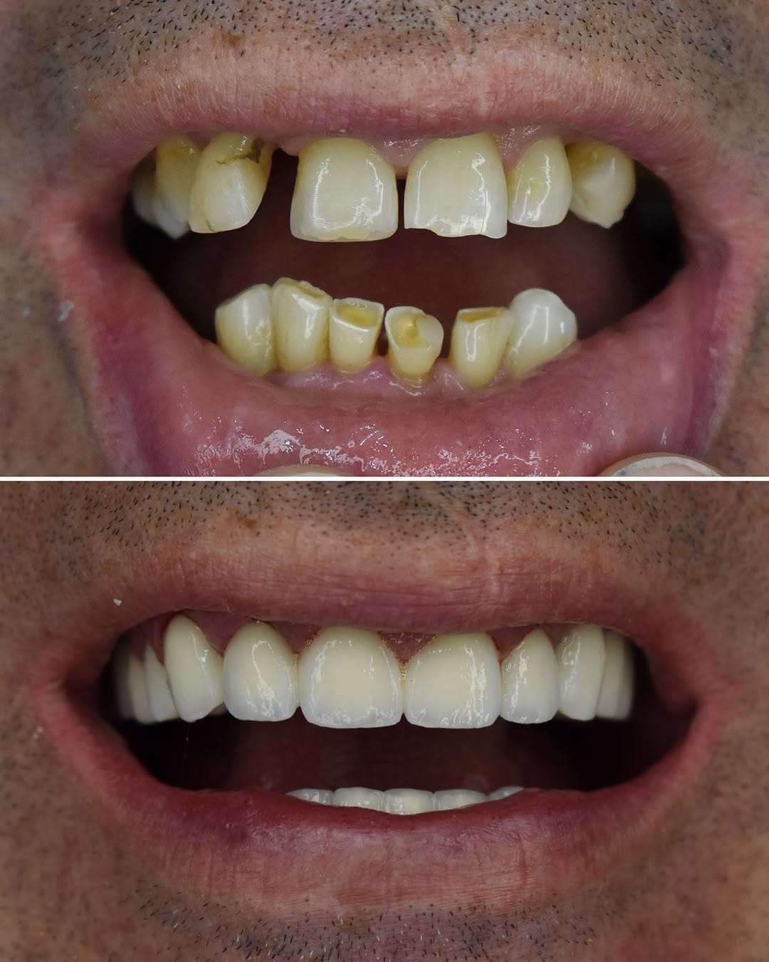 Post 5 by @dental.srbija on Instagram (image)