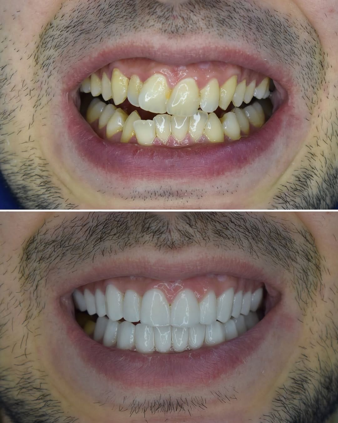 Post 7 by @dental.srbija on Instagram (image)