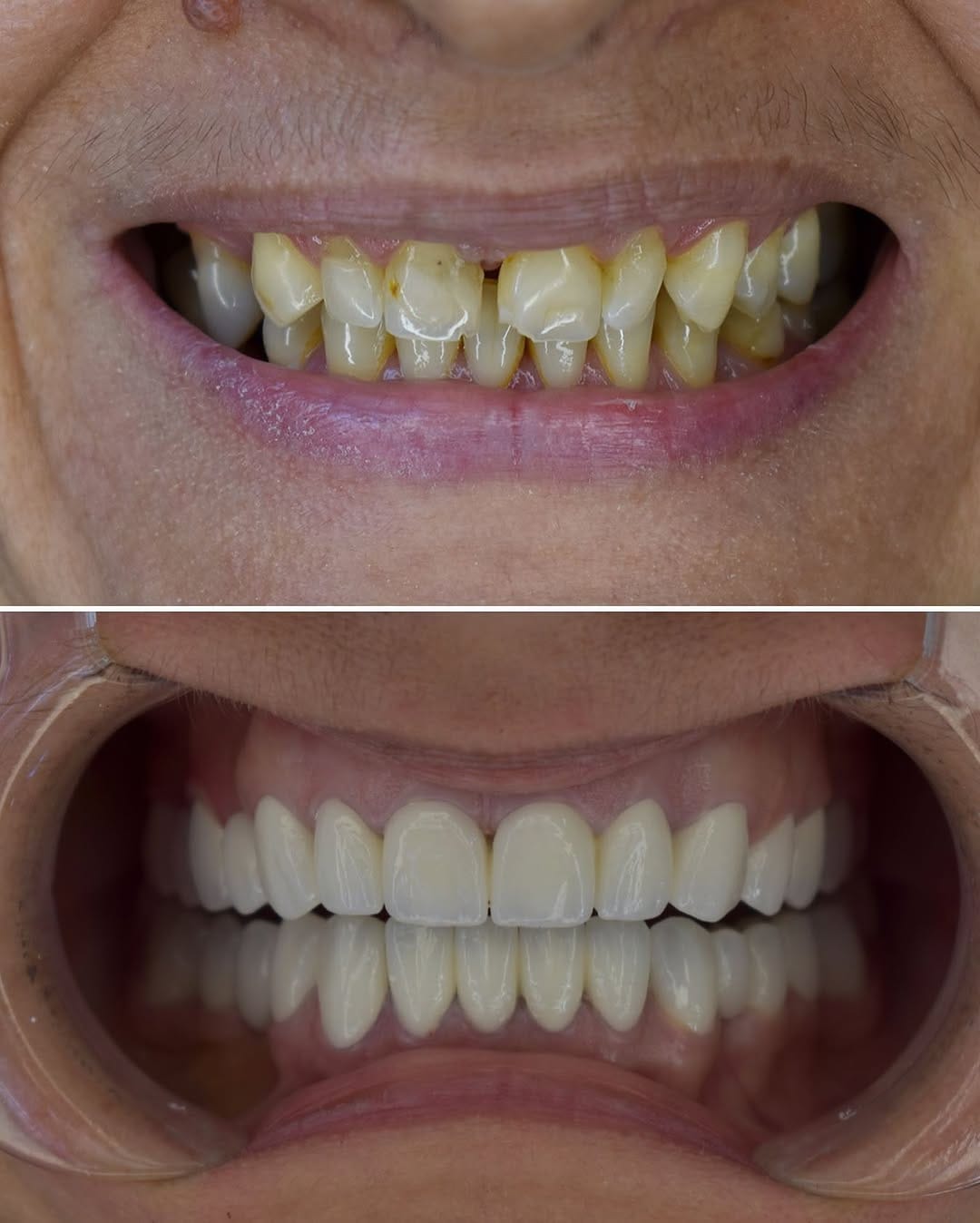 Post 6 by @dental.srbija on Instagram (image)