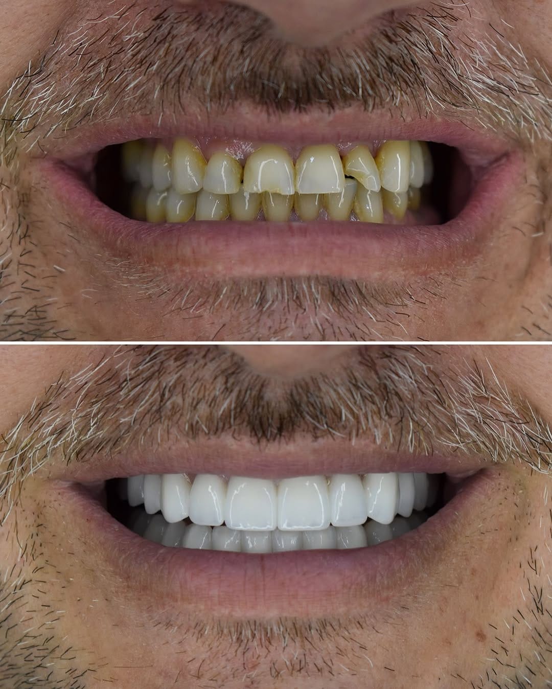Post 9 by @dental.srbija on Instagram (image)