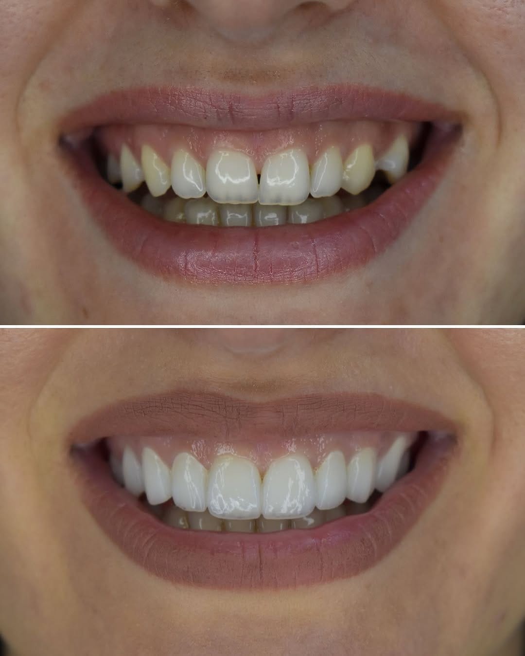 Post 4 by @dental.srbija on Instagram (image)