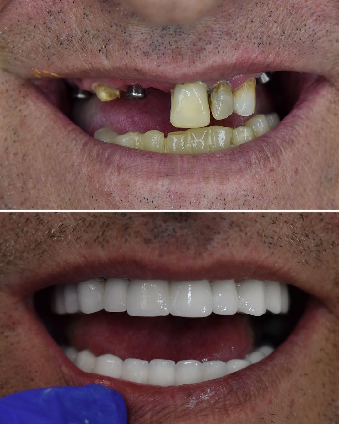 Post 8 by @dental.srbija on Instagram (image)