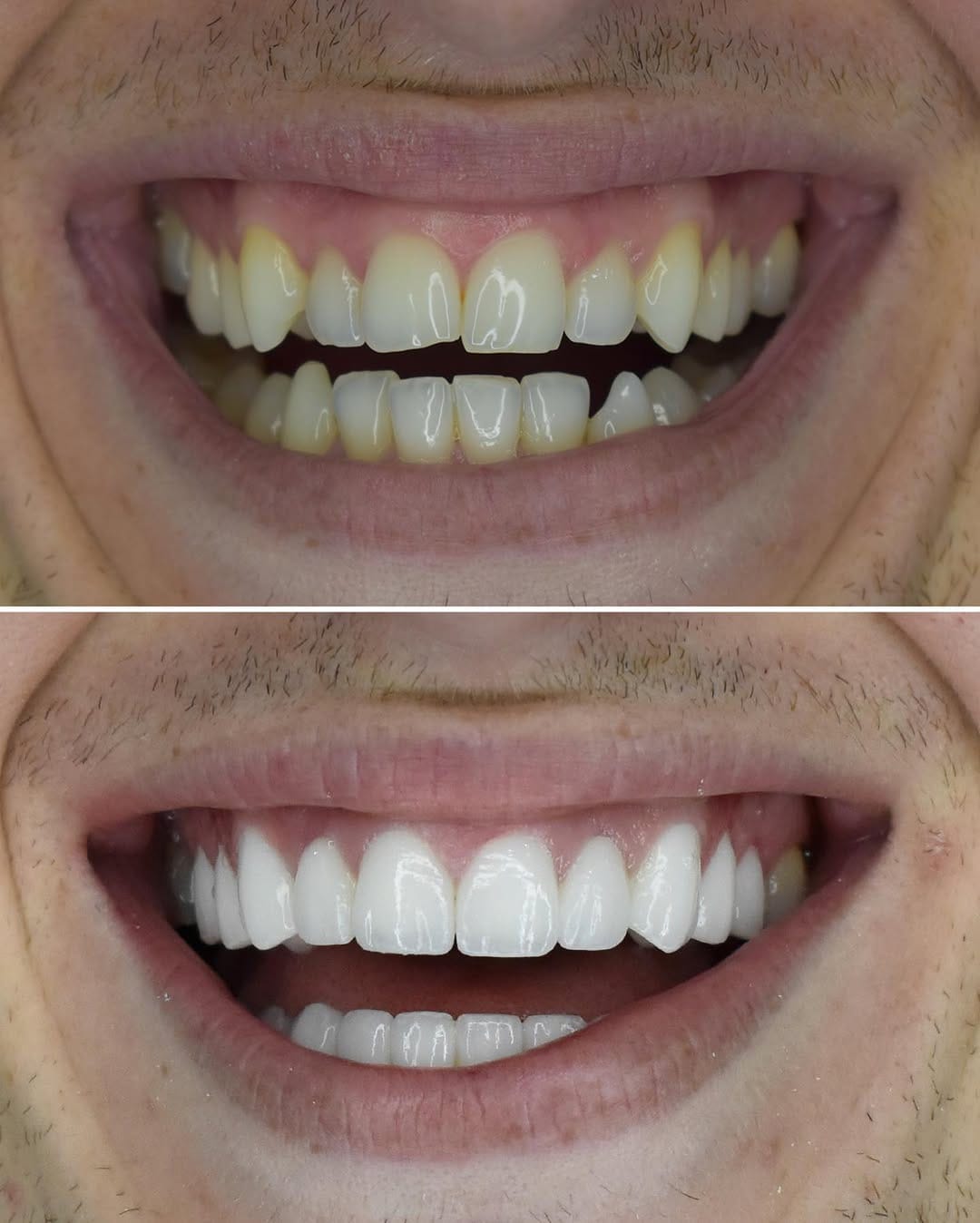 Post 10 by @dental.srbija on Instagram (carousel)