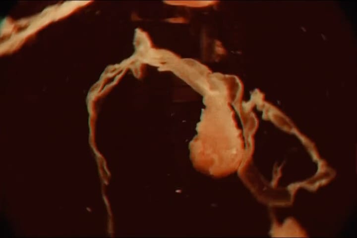 Post 5 by Aswin Kellie on Instagram (video)