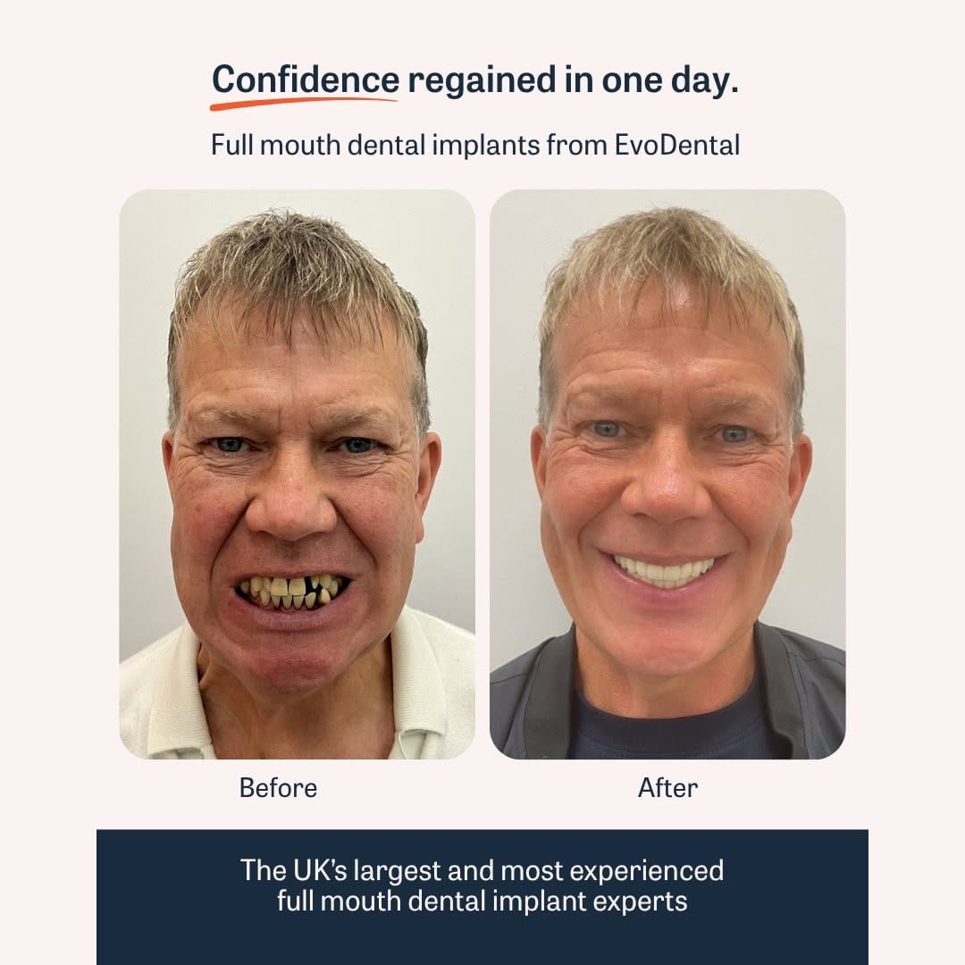 Post 3 by EvoDental on Instagram (image)