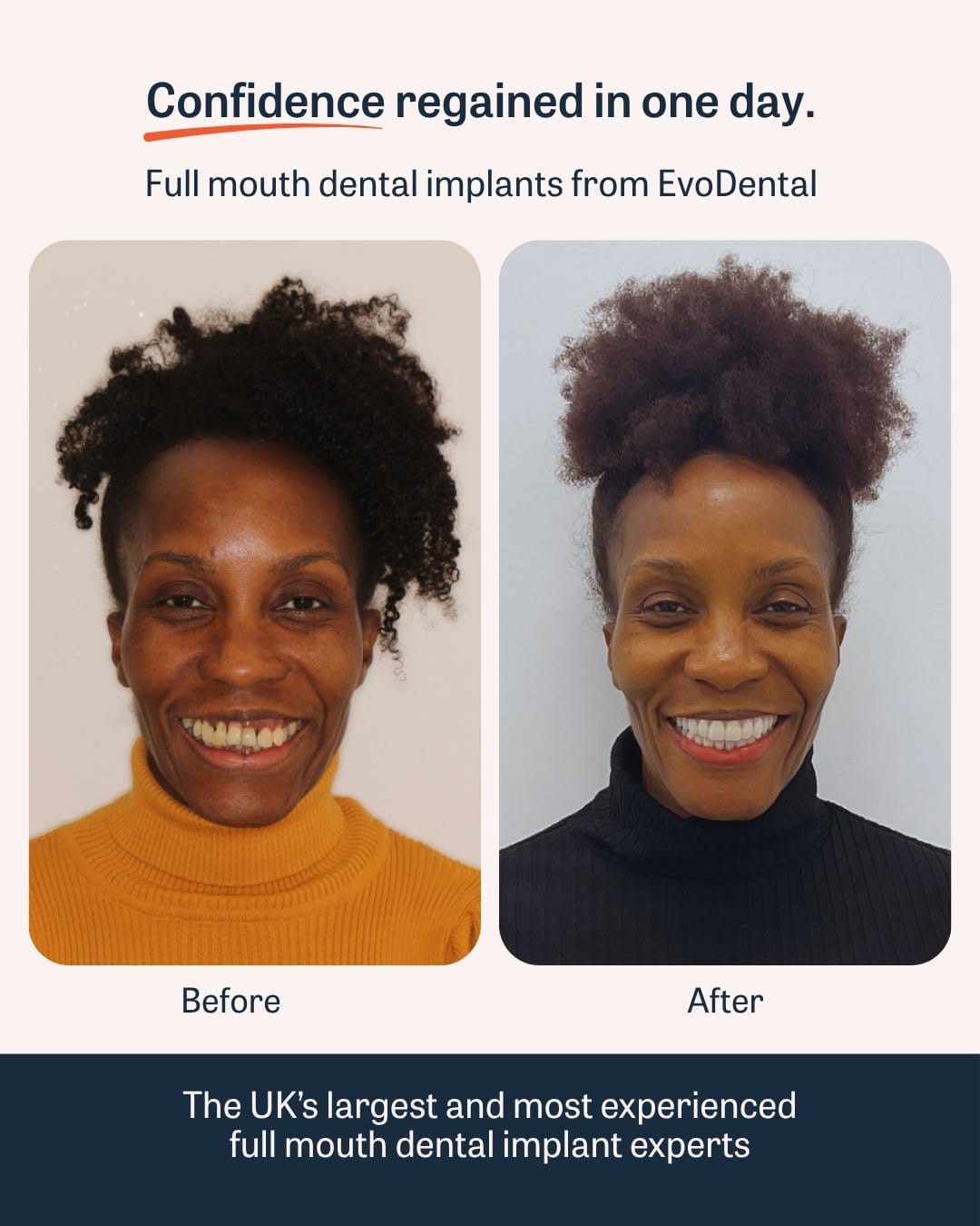 Post 5 by EvoDental on Instagram (image)