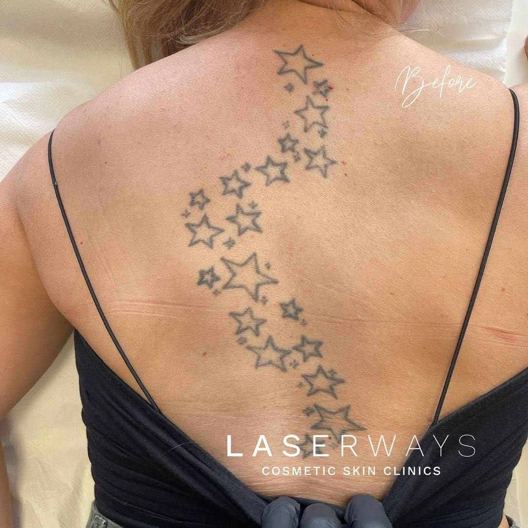 Post 8 by Laserways on Instagram (carousel)