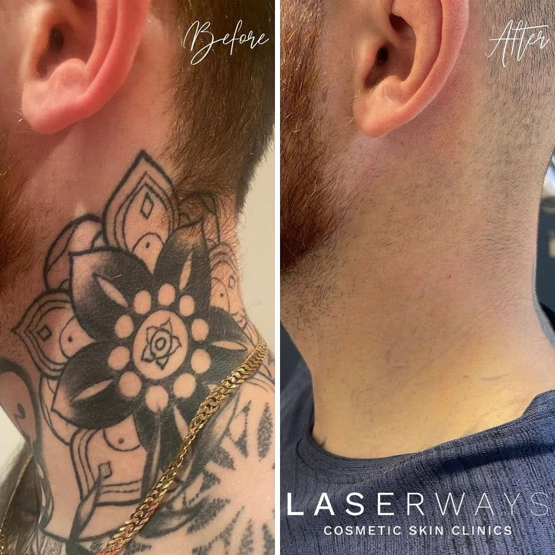 Post 9 by Laserways on Instagram (image)