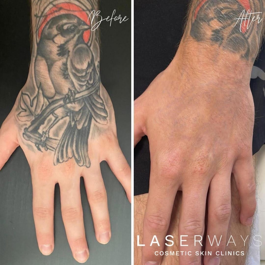 Post 6 by Laserways on Instagram (carousel)
