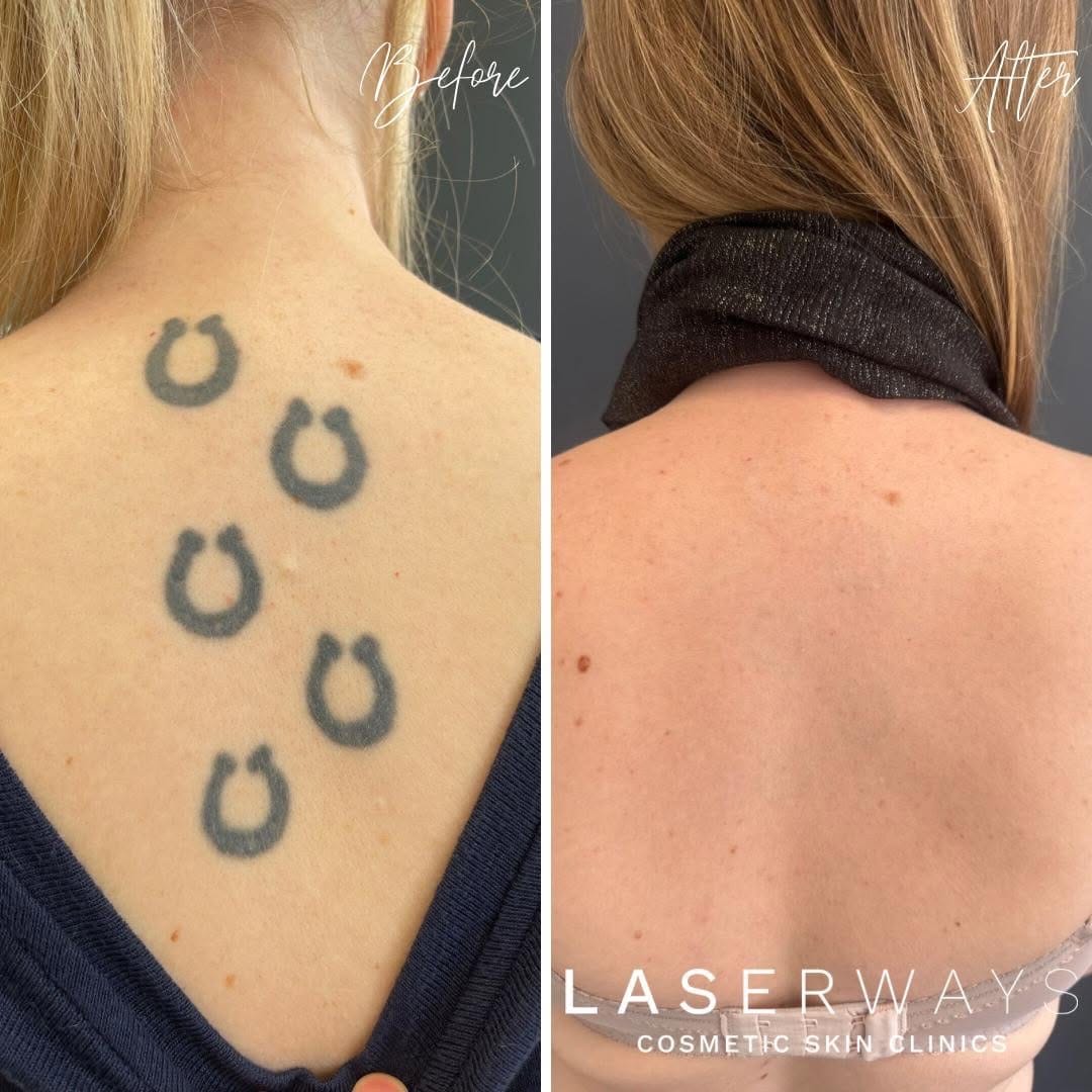Post 3 by Laserways on Instagram (image)