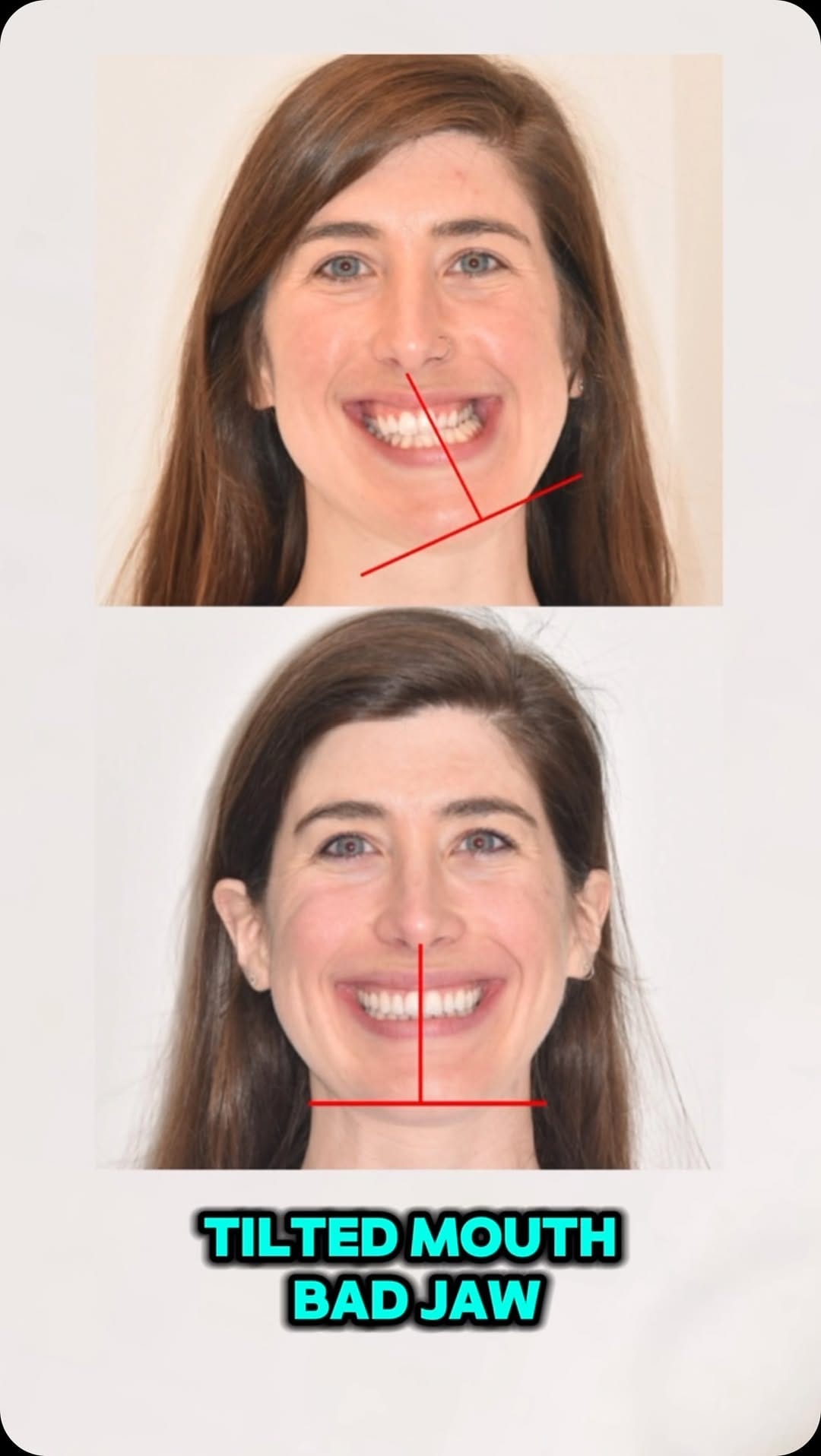 Post 10 by Elite Orthodontics on Instagram (video)