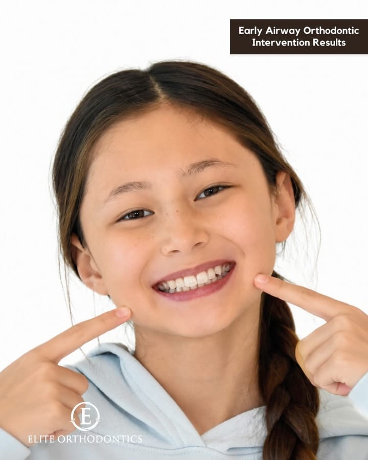 Post 4 by Elite Orthodontics on Instagram (carousel)