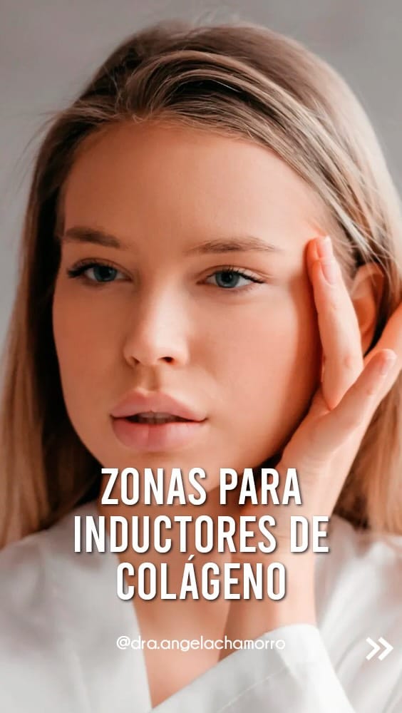 Post 1 by Doctora Ángela Chamorro on Instagram (video)
