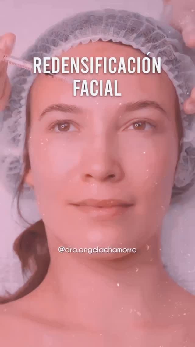 Post 4 by Doctora Ángela Chamorro on Instagram (video)