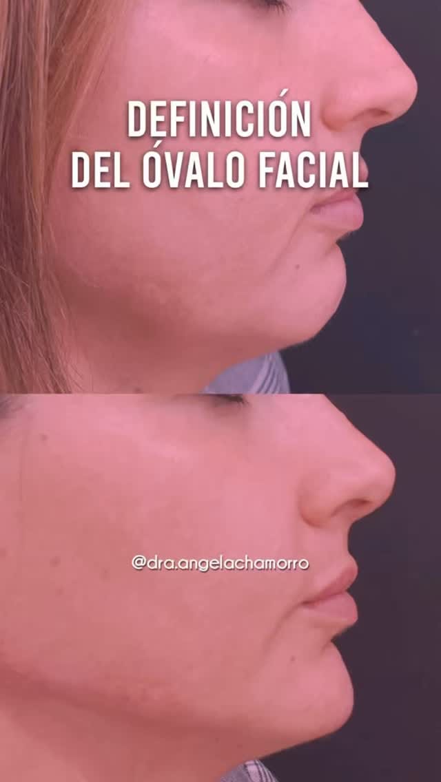 Post 8 by Doctora Ángela Chamorro on Instagram (video)