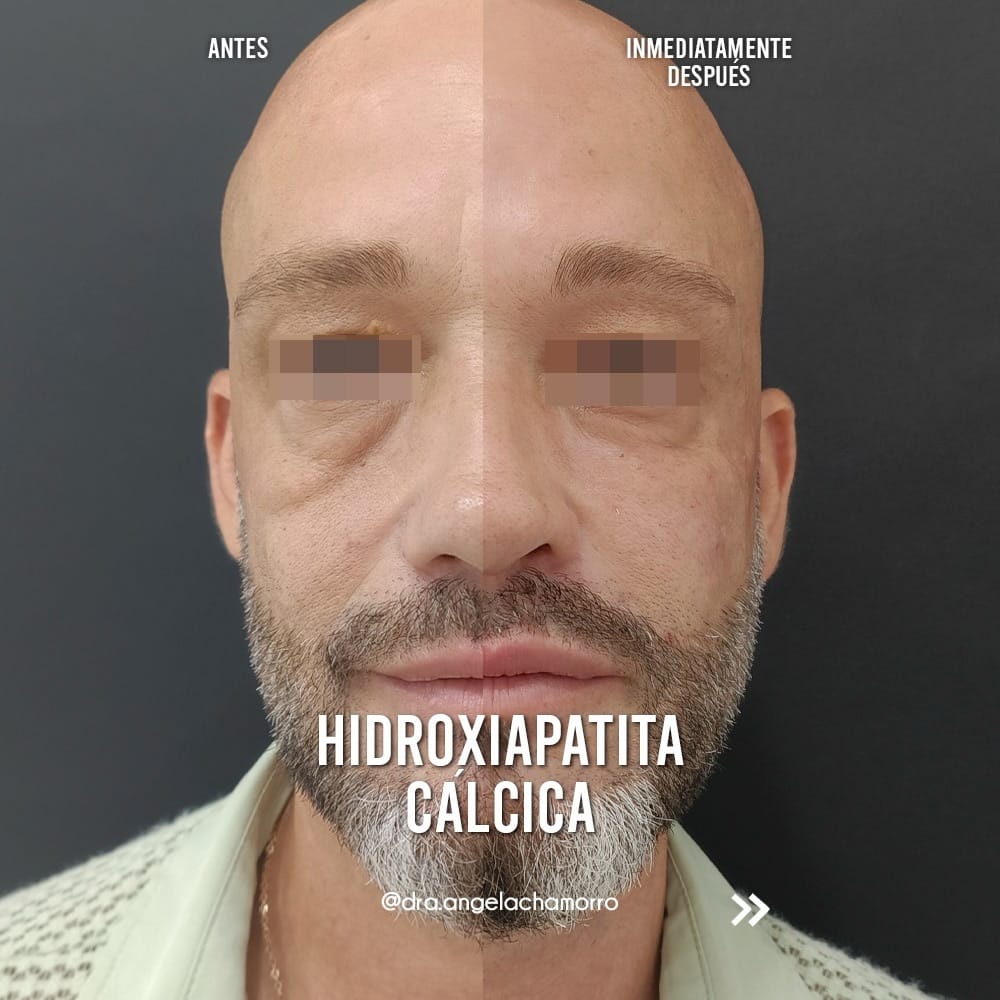 Post 9 by Doctora Ángela Chamorro on Instagram (carousel)