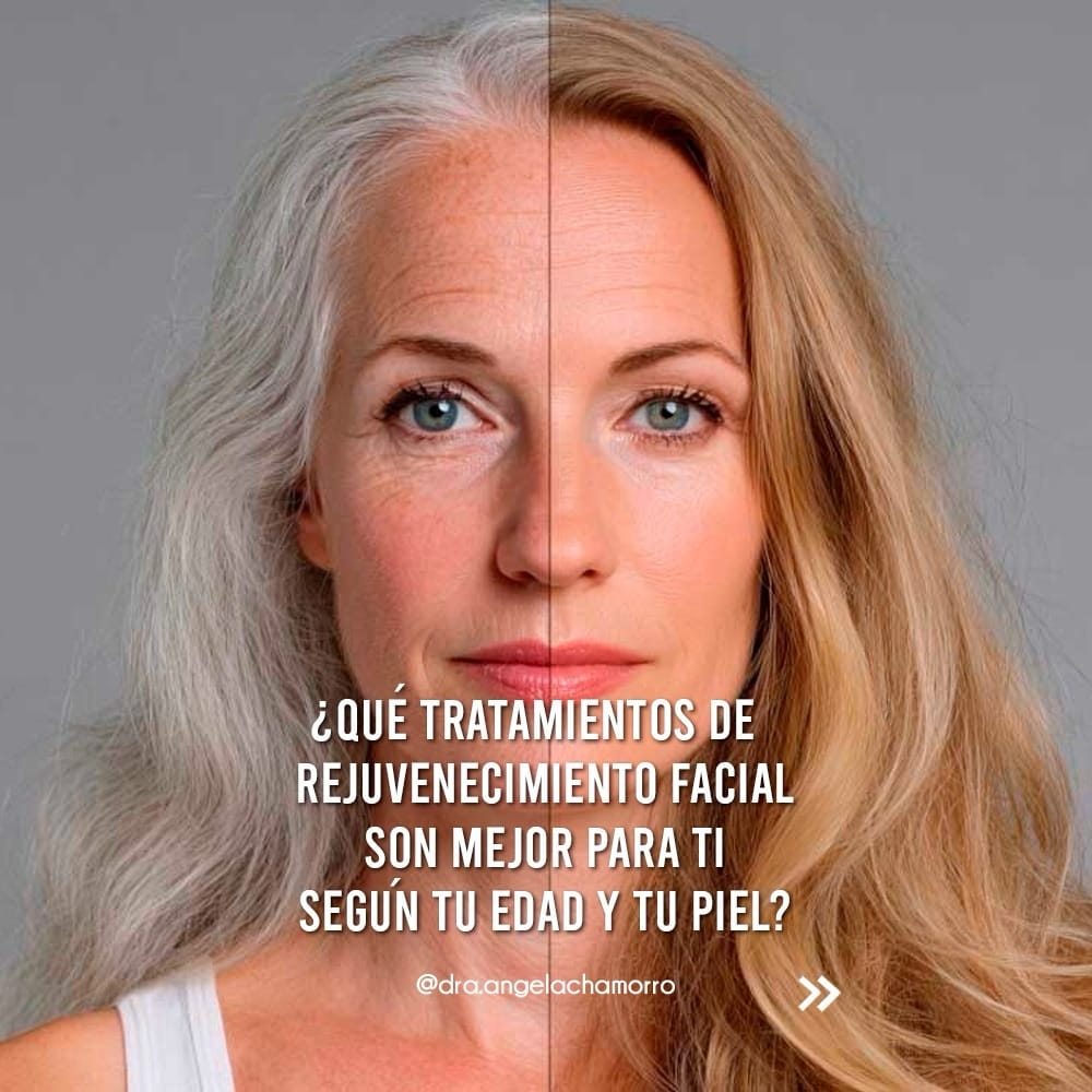 Post 10 by Doctora Ángela Chamorro on Instagram (carousel)
