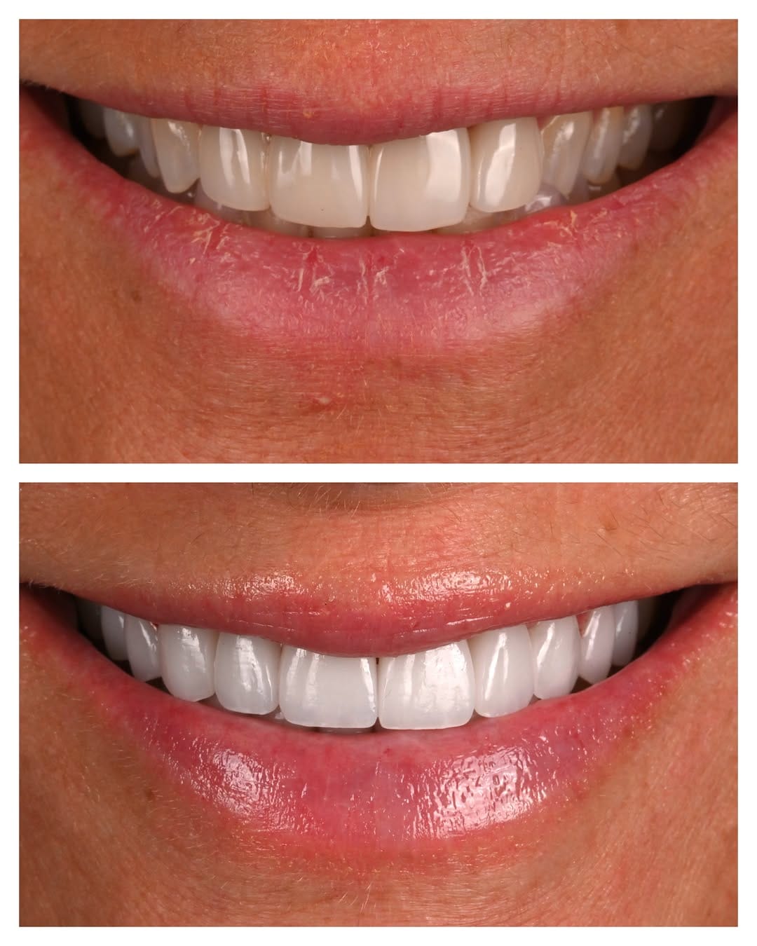 Post 1 by Dra. Anna Wilson | Seville Dental Aesthetics on Instagram (image)