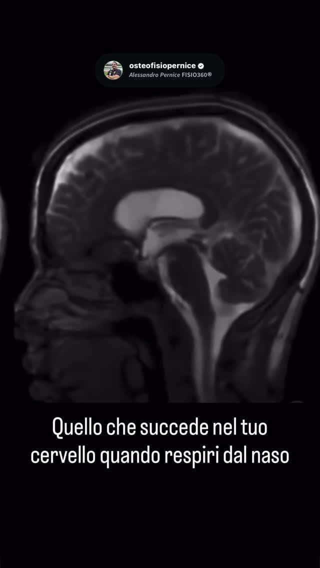 Post 2 by 𝘼𝙡𝙚𝙨𝙨𝙖𝙣𝙙𝙧𝙤 𝙋𝙚𝙧𝙣𝙞𝙘𝙚 𝗙𝗜𝗦𝗜𝗢𝟯𝟲𝟬® on Instagram (video)