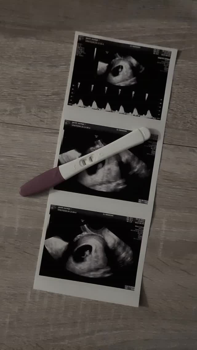 Post 8 by Aurélya | Diéteticienne - Nutritionniste on Instagram (video)
