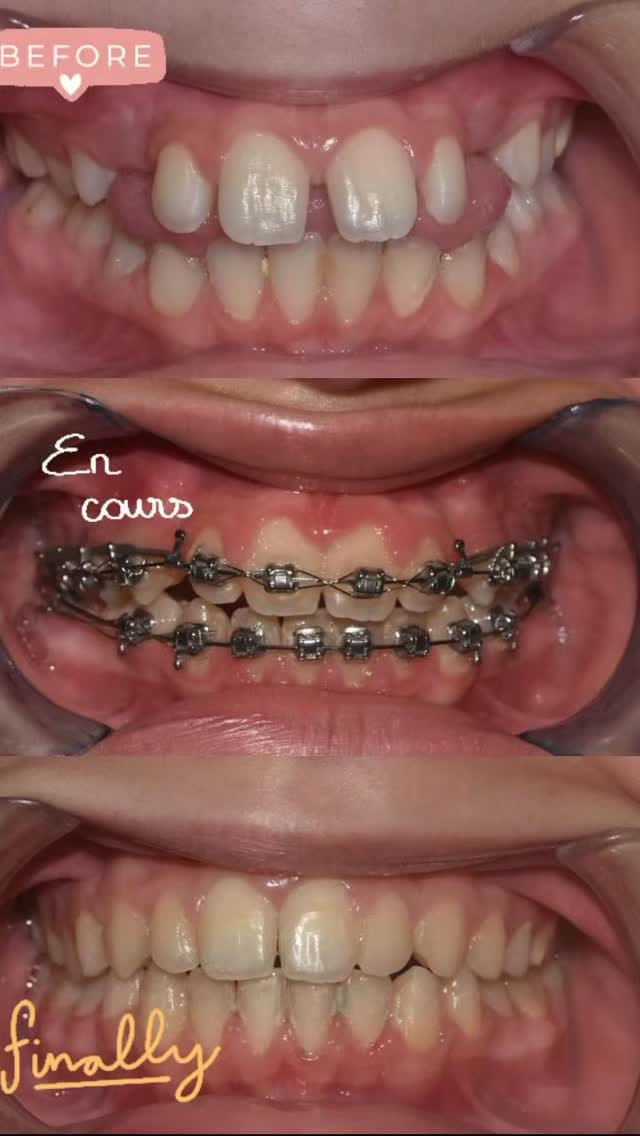 Post 3 by Centre Dentaire Anfa Smile on Instagram (video)